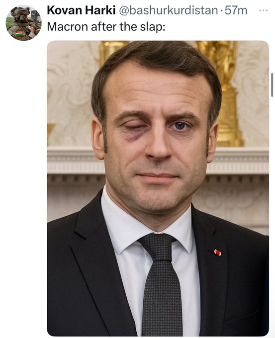 Macron With Swollen Eye Meme